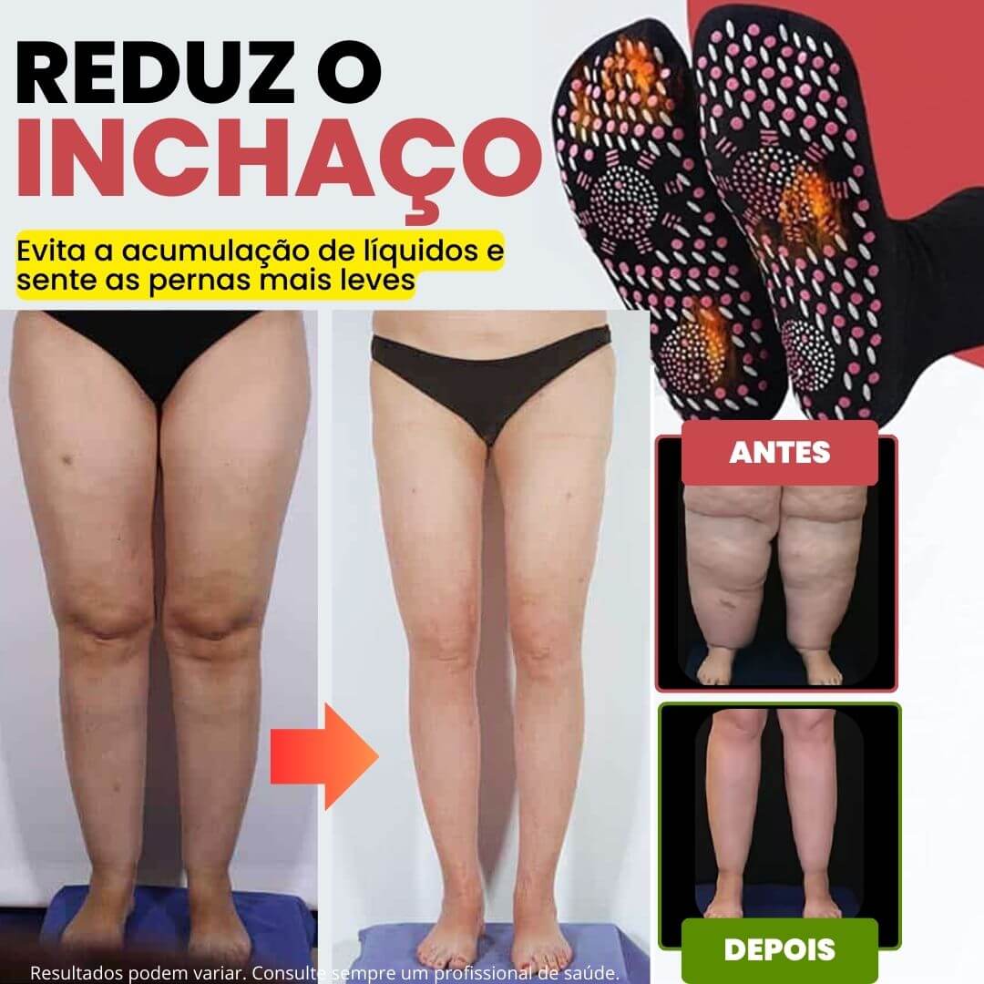 Meias de Acupressão Anti-Varizes
