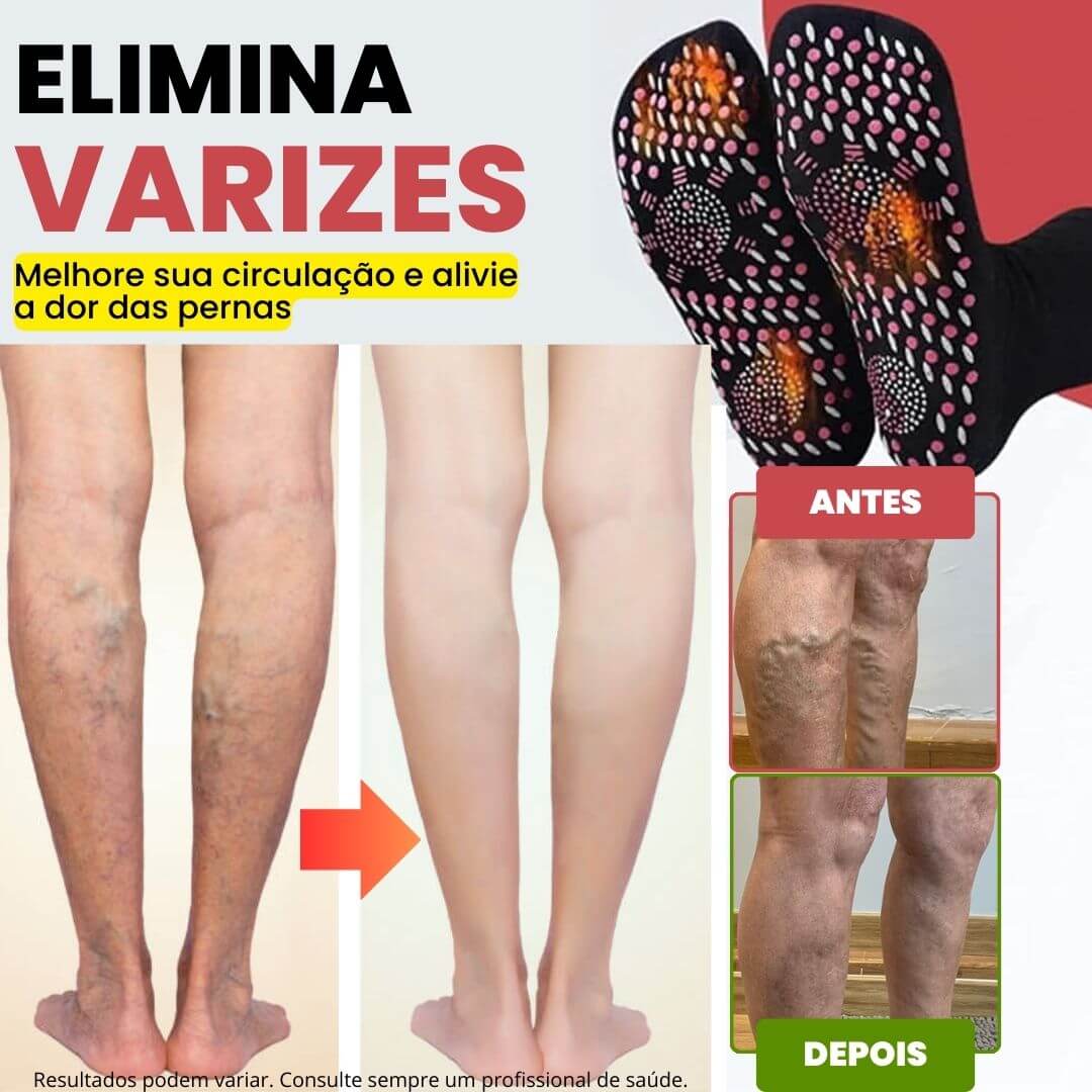 Meias de Acupressão Anti-Varizes