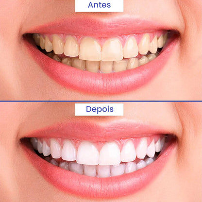 Polidor Branqueador de Dentes - SuperSmile™